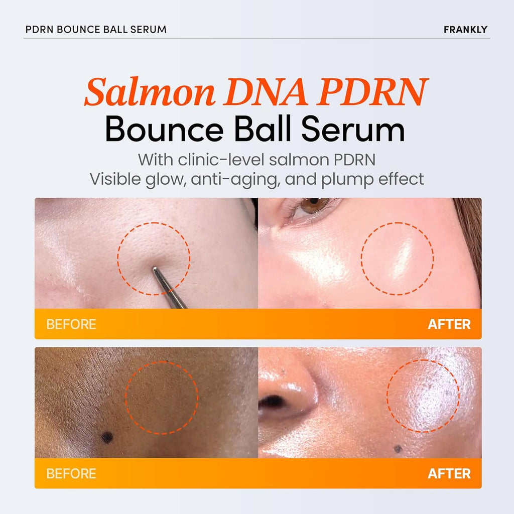 Duo FRANKLY PDRN – Sérum Éclat & Crème Hydratante – 99% Pure Salmon DNA